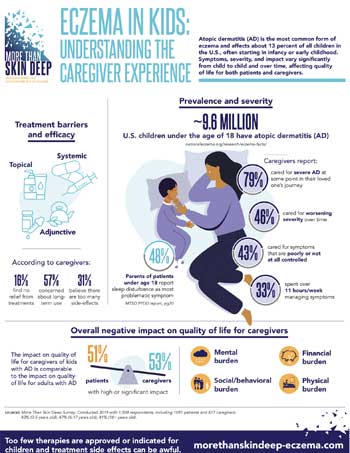 Thumbnail version of a PDF report on eczema in kids