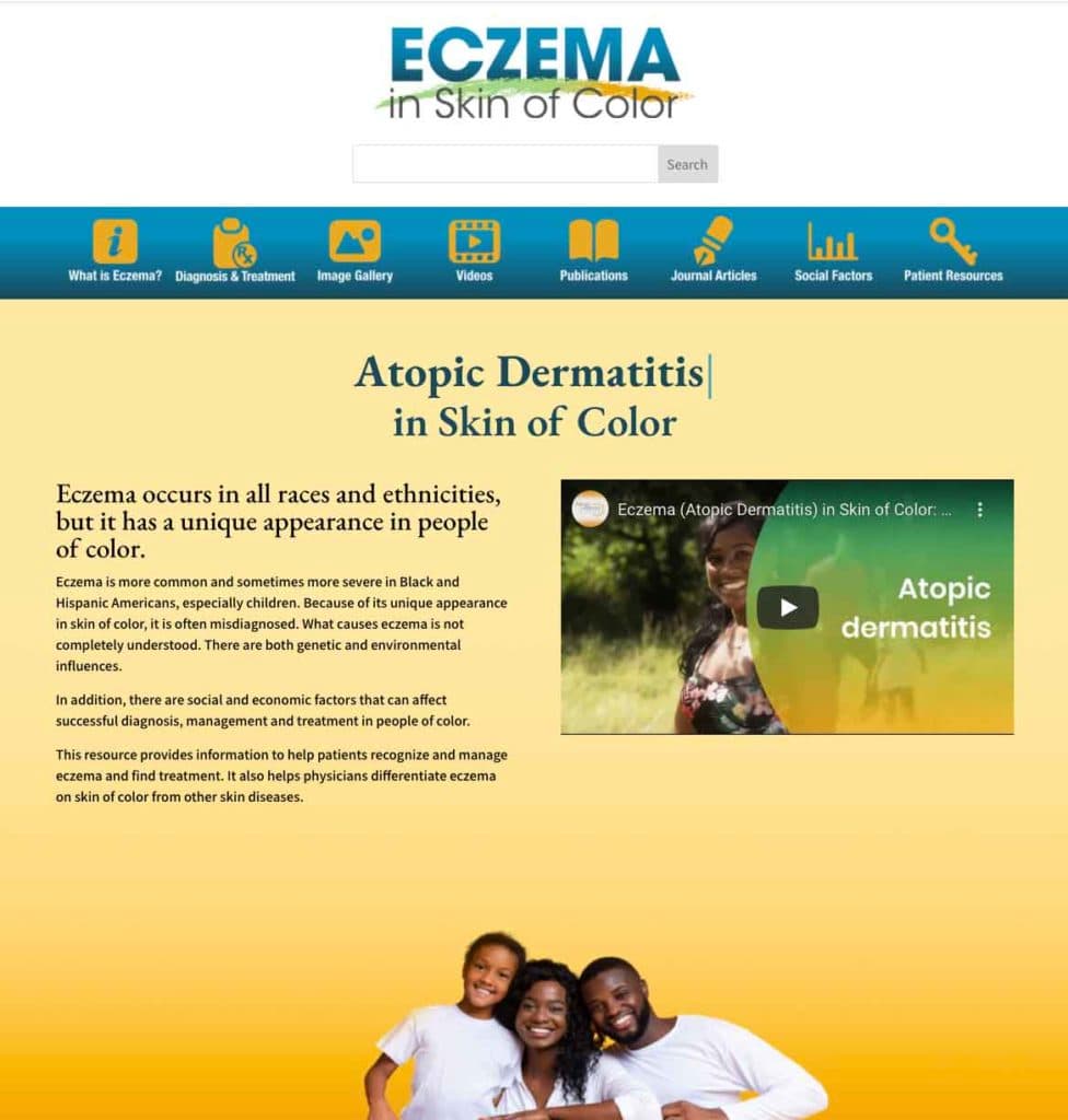 Photo of the Eczema In Skin Of Color website