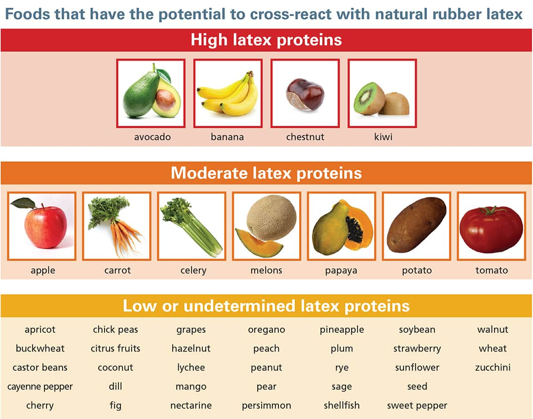 Photo of a chart showing the high, moderate and low food items that can cross react with a natural latex allergy