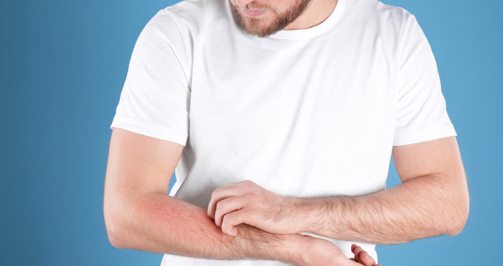 Photo of man shown from the waist to his neck. He is scratching his forearm with his other hand.