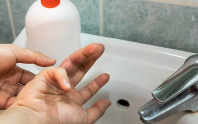 Eczema and Washing Hands Frequently