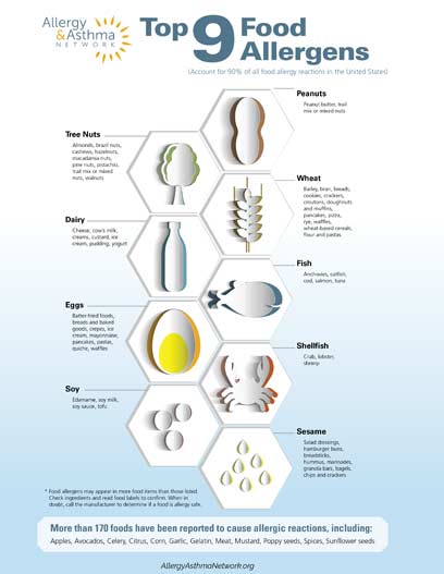 Top 9 Food allergens infographic