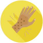 eczema icon of hand