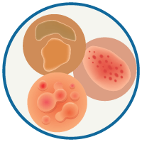 Circle icon of various types of hives.