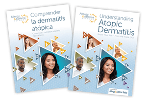 Previews of the Understanding Atopic Dermatitis Guides in English and Spanish