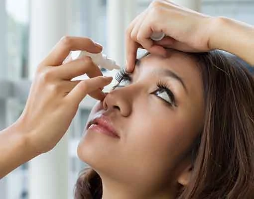 Photo of a woman putting eye drops in her eye